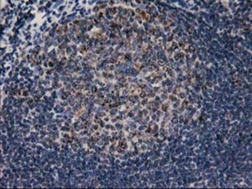 Anti-MFI2 antibody IHC of human breast. Immunohistochemistry of formalin-fixed, paraffin-embedded tissue after heat-induced antigen retrieval.