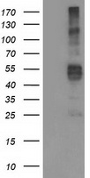 Anti-NR2E3 antibody IHC of human retina. Immunohistochemistry of formalin-fixed, paraffin-embedded tissue after heat-induced antigen retrieval.