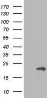 Anti-PDE8B antibody IHC of human thyroid. Immunohistochemistry of formalin-fixed, paraffin-embedded tissue after heat-induced antigen retrieval.