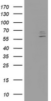 Anti-SLC1A3 / GLAST antibody IHC of human brain, cerebellum, molecular layer and Purkinje layer. Immunohistochemistry of formalin-fixed, paraffin-embedded tissue after heat-induced antigen retrieval.