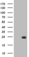 Anti-SLC39A14 antibody IHC of human kidney. Immunohistochemistry of formalin-fixed, paraffin-embedded tissue after heat-induced antigen retrieval.