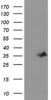Anti-SLC5A9 antibody IHC of human brain, cerebellum. Immunohistochemistry of formalin-fixed, paraffin-embedded tissue after heat-induced antigen retrieval.