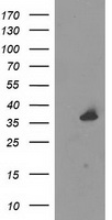 Anti-SSTR5 antibody IHC of human adrenal. Immunohistochemistry of formalin-fixed, paraffin-embedded tissue after heat-induced antigen retrieval.
