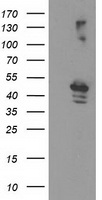 Anti-VRL1 / TRPV2 antibody IHC of human Skin, Melanoma. Immunohistochemistry of formalin-fixed, paraffin-embedded tissue after heat-induced antigen retrieval.
