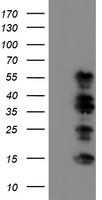 Anti-TRPV4 antibody IHC of human pancreas, islet. Immunohistochemistry of formalin-fixed, paraffin-embedded tissue after heat-induced antigen retrieval.