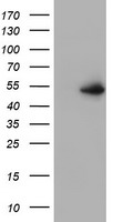 Anti-TSPAN13 antibody IHC of human prostate. Immunohistochemistry of formalin-fixed, paraffin-embedded tissue after heat-induced antigen retrieval.