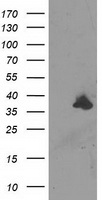 Anti-Histamine 3 Receptor / HRH3 antibody IHC of human brain, neurons. Immunohistochemistry of formalin-fixed, paraffin-embedded tissue after heat-induced antigen retrieval. Antibody dilution 7-15ug/ml.