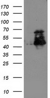 HEK293T cells were transfected with the pCMV6-ENTRY control (Left lane) or pCMV6-ENTRY human KIF2C (RC200254, Middle lane)  cDNA or pCMV6-ENTRY mouse KIF2C (MR210280, Right lane)  cDNA  for 48 hrs and lysed. Equivalent amounts of cell lysates (5 ug per lane) were separated by SDS-PAGE and immunoblotted with anti-KIF2C.  (TA503320, 1:500)