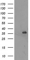 Anti-WNT4 antibody IHC of human thyroid. Immunohistochemistry of formalin-fixed, paraffin-embedded tissue after heat-induced antigen retrieval.