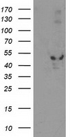 Anti-S100A4 antibody IHC of human uterus, vessel. Immunohistochemistry of formalin-fixed, paraffin-embedded tissue after heat-induced antigen retrieval. Antibody concentration 5ug/ml.