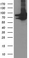 Anti-UCP2 antibody IHC of human adipocytes. Immunohistochemistry of formalin-fixed, paraffin-embedded tissue after heat-induced antigen retrieval. Antibody concentration 75ug/ml.