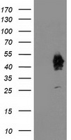 Anti-SLITRK6 antibody IHC of human liver. Immunohistochemistry of formalin-fixed, paraffin-embedded tissue after heat-induced antigen retrieval.