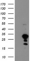 HEK293T cells were transfected with the pCMV6-ENTRY control (Left lane) or pCMV6-ENTRY KIAA0495 (RC210801, Right lane) cDNA for 48 hrs and lysed. Equivalent amounts of cell lysates (5 ug per lane) were separated by SDS-PAGE and immunoblotted with anti-KIAA0495. Positive lysates LY404085 (100ug) and LC404085 (20ug) can be purchased separately from OriGene.