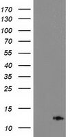 HEK293T cells were transfected with the pCMV6-ENTRY control (Left lane) or pCMV6-ENTRY PDE6G (RC216236, Right lane) cDNA for 48 hrs and lysed. Equivalent amounts of cell lysates (5 ug per lane) were separated by SDS-PAGE and immunoblotted with anti-PDE6G. Positive lysates LY419220 (100ug) and LC419220 (20ug) can be purchased separately from OriGene.