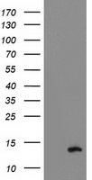 HEK293T cells were transfected with the pCMV6-ENTRY control (Left lane) or pCMV6-ENTRY PDE6G (RC216236, Right lane) cDNA for 48 hrs and lysed. Equivalent amounts of cell lysates (5 ug per lane) were separated by SDS-PAGE and immunoblotted with anti-PDE6G. Positive lysates LY419220 (100ug) and LC419220 (20ug) can be purchased separately from OriGene.