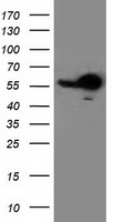 WB using anti-MCM2 antibody shows detection of both phosphorylated and unphosphorylated MCM2 in nuclear extracts from elutriated human cells (MO59K/K562). Panel A shows WB results for asynchronous cells lyastes (lane 1), cells arrested in early S with aphidicolin (Lane 2), and cells arrested in mitosis with nocodazole (lane 3). Panel B shows a schematic diagram of bands representing phosphorylated and unphosphorylated MCM2 present in these preparations. The primary antibody was diluted 1:400.