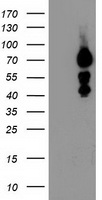 WB using Anti-SLIT-2 antibody shows detection of a band at ~165 kDa (lane 1) corresponding to SLIT-2 present in a chicken spinal cord whole cell lysate (arrowhead). The primary antibody diluted to 1:1, 350. Reaction occurred overnight at 4°C followed by washes and reaction with a 1:10,000 dilution of IRDye800 conjugated Gt-a-Rabbit IgG [H&L] MX for 45 min at RT. Molecular weight estimation was made by comparison to prestained MW markers in lane M (700 nm channel, red).