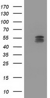 WB using Anti-S-100 antibody shows detection of a band ~11 kDa corresponding to bovine S-100 monomer (100 ng loaded, arrowhead lane 1). The antibody also detects S-100 from rat brain lysate (lane 2). The primary antibody was diluted to 1:1,000 for 2h at RT, followed by washes and reaction with a 1:10,000 dilution of IRDye™800 conjugated Gt-a-Rabbit IgG [H&L] for 45 min at room temperature.