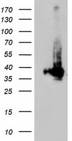 ChIP using Mre11 (S. cerevisiae) antibody. Chromatin was immunoprecipitated with the antibody at the stated dilutions. Immunocomplexes were captured using polyacrylamide bead linked secondary antibodies. The resultant immunoprecipitate was probed by multiplex PCR, using primers 20 bp from the MAT locus double strand break (lower arrow) and 67 kb from the break (upper band, control locus).