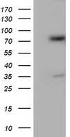HEK293T cells were transfected with the pCMV6-ENTRY control (Left lane) or pCMV6-ENTRY ELK3 (RC203114, Right lane) cDNA for 48 hrs and lysed. Equivalent amounts of cell lysates (5 ug per lane) were separated by SDS-PAGE and immunoblotted with anti-ELK3. Positive lysates LY401602 (100 ug) and LC401602 (20 ug) can be purchased separately from OriGene.
