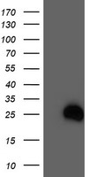 HEK293T cells were transfected with the pCMV6-ENTRY control (Left lane) or pCMV6-ENTRY ELK3 (RC203114, Right lane) cDNA for 48 hrs and lysed. Equivalent amounts of cell lysates (5 ug per lane) were separated by SDS-PAGE and immunoblotted with anti-ELK3. Positive lysates LY401602 (100 ug) and LC401602 (20 ug) can be purchased separately from OriGene.