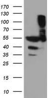 Western blot using Anti-Human TNF-a (RABBIT) Antibody. Membrane blocked in 1% BSA-TBS-T 30 min RT, Rb-a-TNF alpha added at 1:1000 in 1% BSA-TBS-T o/n 4°C, DyLight 649 Gt-a-Rb 611-143-122 added at 1:20,000 in MB-070 30 min RT.