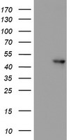 HEK293T cells were transfected with the pCMV6-ENTRY control (Left lane) or pCMV6-ENTRY NAPEPLD (RC209877, Right lane) cDNA for 48 hrs and lysed. Equivalent amounts of cell lysates (5 ug per lane) were separated by SDS-PAGE and immunoblotted with anti-NAPEPLD. Positive lysates LY404703 (100ug) and LC404703 (20ug) can be purchased separately from OriGene.