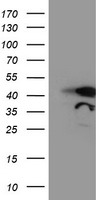 WB of Rabbit anti-Gli-3 antibody. Lane 1: human brain whole cell lysate. Lane 2: human lung whole cell lysate. Lane 3: human spleen whole cell lysate. Lane 4: mouse brain whole cell lysate. Lane 5: mouse lung whole cell lysate. Load: 20ug per lane. Primary antibody: Gli-3 antibody at 1:500 for overnight at 4°C. Secondary antibody: IRDye800™ rabbit secondary antibody at 1:10,000 for 45 min at RT. Block: 5% BLOTTO overnight at 4°C.