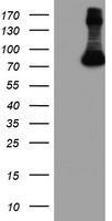 WB using Anti-Fbp5B antibody. Panels A and B show two identical membranes containing marker, in vitro translated Fbp5b (Fbp5b ivt), and a whole cell extract from 293T cells loaded in duplicate). Panel A shows antibody reactivity. Panel B shows antibody reactivity after first pre-incubating the antibody with the immunizing peptide Peptide inhibition completely removes the in vitro translated band and greatly reduces the endogenous band from 293T cells.
