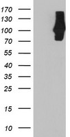 WB using anti-hCASZ1 antibody. This blot shows detection of endogenous and transfected human CASZ1 protein in fresh whole cell lysate (~30ug). The primary antibody diluted to 1:1,000, incubated 1.5 hours at room temperature, and incubated with HRP-conjugated Goat Anti-Rabbit antibody for 45 min. at room temperature. Lane 1, BE2 (s) cell lysate. Lane 2, BE2 (N) cell lysate. Lane 3, SY5Y transfected with hCASZ5 (125kDa). Lane 4, SY5Y transfected with hCASZ11 (190kDa).