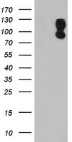 WB using Anti-DNAPKcs antibody shows detection of a 460 kDa band corresponding to human DNAPKcs in various preparations. Lane 1: Fus1 untreated, Lane 2: Fus1 IR (20Gy, 4h), Lane 3: Fus1 DNAPK inhibitor + IR, Lane 4: MO59J (DNAPK-) untreated, Lane 5: MO59J IR, Lane 6: Fus1 untreated, Lane 7: Fus1 IR (20Gy, 4h), Lane 8: Fus1 DNAPK inhibitor + IR, Lane 9: MO59J untreated, Lane 10: MO59J IR.The primarey antibody was used at 1:1,000.