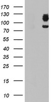 WB showing detection of Rat IL-17A. 50ng of Rat IL-17A (Lane 1) was run on a 4-20% gel and transferred to 0.45 Âµm nitrocellulose. Anti-Rat IL-17A (RABBIT) Antibody Biotin Conjugated secondary antibody was used at 1:5000 in Blocking Buffer for Fluorescent WBting (p/n MB-070). HRP Streptavidin (p/n S000-03) was used at 1:40,000 in MB-070 for 30 min at 20°C and imaged using the Bio-Rad VersaDocÂ® 4000 MP. Arrow indicates correct 15 kDa molecular weight position expected for Rat IL-17A.