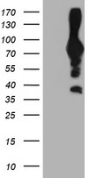 Western blot using affinity purified anti-Pogz antibody shows detection of Pogz protein (arrowhead) in adult mouse thymus and spleen tissue lysate (Panel A). The lower molecular weight bands may be cross reactive proteins. Pre-incubation of antibody with the immunizing peptide blocks specific antibody reactivity (Panel B). Primary antibody was used at 1:20,000. Personal Communication, K.O. Gudmundsson and J. Keller, NCI, Frederick, MD.