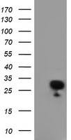 HEK293T cells were transfected with the pCMV6-ENTRY control (Left lane) or pCMV6-ENTRY NUBPL (RC204385, Right lane) cDNA for 48 hrs and lysed. Equivalent amounts of cell lysates (5 ug per lane) were separated by SDS-PAGE and immunoblotted with anti-NUBPL. Positive lysates LY410869 (100 ug) and LC410869 (20 ug) can be purchased separately from OriGene.