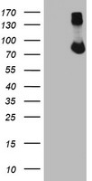 WB using anti-Notch 2 (intra) antibody shows detection of a band at ~110 kDa corresponding to active Notch 2 protein (arrowhead). WB analysis was performed for Notch 2 expression using human mesothelial SV40 cells lysate obtained fromtransfected with a plasmid encoding a constitutively active Notch 2 (intra cellular Notch 2). Lanes 1-3 contain lysate 24 h (1), 48 h (2), and 72 h (3) post transfection. Lanes 4-6 are the corresponding control cells (untransfected). Anti-Notch 2 was used at 1:400.