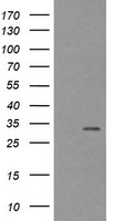 WB using Anti-Gli-2 antibody shows detection of Gli-2 protein in rat testes (lane 1) and human HEK293 (lane 2) whole cell lysates (arrowhead). Each lane contains approximately 35ug of lysate. Primary antibody was used at a 1:400 dilution. The membrane was washed and reacted with a 1:10,000 dilution of IRDye® 800 conjugated Gt-a-Rabbit IgG [H&L] MX10 for 45 min at RT. Molecular weight estimation was made by comparison to prestained MW markers in lane M (700 nm channel, red).