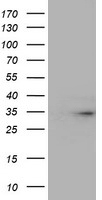 Western blot using affinity purified anti-Nedd4 antibody shows detection of a 115 kDa band corresponding to endogenous Nedd4 (arrowhead) in MDA-MB-435S cell lysates. The blot was blocked with B501-0500 5% BLOTTO overnight at 4°C. Primary antibody was used at a 1:350 dilution in 5% BLOTTO followed by reaction with a 1:20,000 dilution of HRP goat anti-rabbit IgG in #MB-070 Blocking Buffer for Fluorescent Western Blotting. ECL was used for detection.