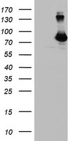Dot Blot of Rabbit anti-IL-7 Receptor antibody. Antigen: IL-7 Receptor and IL-7 Receptor pY449 forms of the immunizing peptide and THRB1 and THRB1 pY171 as controls. Load: 3.0, 0.3, 0.1, 0.05ug as indicated. Primary antibody: IL-7 Receptor antibody at 1:400 for 45 min at 4°C. Secondary antibody: Dylight™488 rabbit secondary antibody at 1:10,000 for 45 min at RT. Block: 5% BLOTTO overnight at 4°C.