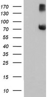 WB using Anti-eIF3S6/Int6 antibody shows detection of endogenous eIF3S6/Int6 in whole cell extracts from murine (HC-11 and NIH3T3), monkey (CV-1 and Cos-1), and human (HEK293T) cell lines as well as over-expressed eIF3S6/Int6 (control transfected flag-tagged Int6).The identity of the higher and lower molecular weight bands is unknown. The band at ~48 kDa, indicated by the arrowhead, corresponds to flag-tagged EIF3S6/Int6. Primary antibody was used at 1:1000.