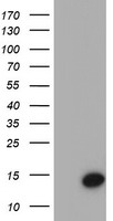 WB using Anti-ATDC (Ac-K116) antibody shows detection of a 66 kDa band corresponding to over-expressed, acetylated lysine (K116) ATDC (arrowhead) in transfected 293T cells. No staining is noted for cells transfected with empty vector only. No staining is noted for cells transfected with an ATDC K116R mutant (K to R transversion lacks site for acetylation). In each instance, samples were prepared with and without TSA (1.3uM, 6 hr) which inhibits deacetylation.