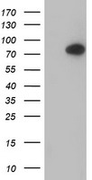 Anti-Ubiquitin antibody, generated by immunization with Ubiquitin coupled to Rabbit IgG, was tested by WB against total cell extract from yeast. Dilution of the antibody between 1:200 and 1:1,000 showed strong reactivity with Ubiquitinated proteins. In this blot the antibody was used at 1:500. Detection occurred using a 1:2000 dilution of HRP-labeled Donkey anti-Rabbit IgG.