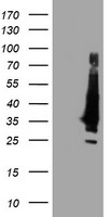Western blot using anti-SPS1 antibody shows detection of endogenous SPS1 in NIH3T3 cell. No signal is seen in lysates from cells after pre-treatment with SPS1 siRNA. Endogenous SPS1 can be detected in mouse kidney and liver tissue lysates. Negligible cross-reactivity is seen against recombinant SPS2. The primary antibody was used at a 1:1000 dilution. Personal Communication, D. Hatfield, NCI, Bethesda, MD.
