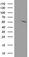 Western blot analysis of SEPT1 in Raji cell lysate with SEPT1 antibody at 1ug/ml in (A) the absence and (B) the presence of blocking peptide.