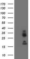 HEK293T cells were transfected with the pCMV6-ENTRY control (Left lane) or pCMV6-ENTRY IGJ (RC207932, Right lane) cDNA for 48 hrs and lysed. Equivalent amounts of cell lysates (5 ug per lane) were separated by SDS-PAGE and immunoblotted with anti-IGJ. Positive lysates LY403400 (100ug) and LC403400 (20ug) can be purchased separately from OriGene.