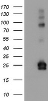HEK293T cells were transfected with the pCMV6-ENTRY control (Left lane) or pCMV6-ENTRY IGJ (RC207932, Right lane) cDNA for 48 hrs and lysed. Equivalent amounts of cell lysates (5 ug per lane) were separated by SDS-PAGE and immunoblotted with anti-IGJ. Positive lysates LY403400 (100ug) and LC403400 (20ug) can be purchased separately from OriGene.