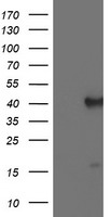 HEK293T cells were transfected with the pCMV6-ENTRY control (Left lane) or pCMV6-ENTRY PECI (RC204994, Right lane) cDNA for 48 hrs and lysed. Equivalent amounts of cell lysates (5 ug per lane) were separated by SDS-PAGE and immunoblotted with anti-PECI. Positive lysates LY401844 (100ug) and LC401844 (20ug) can be purchased separately from OriGene.