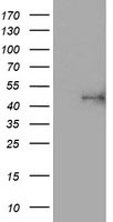 HEK293T cells were transfected with the pCMV6-ENTRY control (Left lane) or pCMV6-ENTRY DPP9 (RC229388, Right lane) cDNA for 48 hrs and lysed. Equivalent amounts of cell lysates (5 ug per lane) were separated by SDS-PAGE and immunoblotted with anti-DPP9. Positive lysates LY403380 (100 ug) and LC403380 (20 ug) can be purchased separately from OriGene.