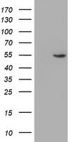 HEK293T cells were transfected with the pCMV6-ENTRY control (Left lane) or pCMV6-ENTRY PFKP (RC200673, Right lane) cDNA for 48 hrs and lysed. Equivalent amounts of cell lysates (5 ug per lane) were separated by SDS-PAGE and immunoblotted with anti-PFKP. Positive lysates LY400932 (100 ug) and LC400932 (20 ug) can be purchased separately from OriGene.