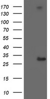 HEK293T cells were transfected with the pCMV6-ENTRY control (Left lane) or pCMV6-ENTRY SERPINB2 (RC203139, Right lane) cDNA for 48 hrs and lysed. Equivalent amounts of cell lysates (5 ug per lane) were separated by SDS-PAGE and immunoblotted with anti-SERPINB2. Positive lysates LY400915 (100 ug) and LC400915 (20 ug) can be purchased separately from OriGene.