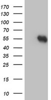 HEK293T cells were transfected with the pCMV6-ENTRY control (Left lane) or pCMV6-ENTRY FBXO31 (RC203518, Right lane) cDNA for 48 hrs and lysed. Equivalent amounts of cell lysates (5 ug per lane) were separated by SDS-PAGE and immunoblotted with anti-FBXO31. Positive lysates LY411131 (100 ug) and LC411131 (20 ug) can be purchased separately from OriGene.